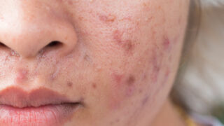 原因 知ってる この情報